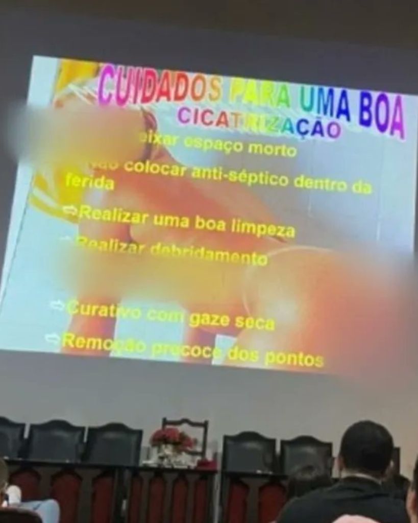 Cremal vai apurar uso de foto de mulher nua em palestra de médico durante  curso em Maceió - Portal Agora Alagoas