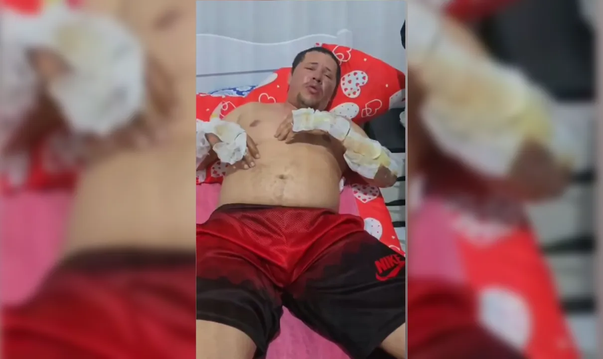 Motorista de app queimado